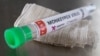 Un tubo de ensayo con la etiqueta "virus de viruela del mono positivo". Foto Reuters.