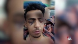 پارسا قبادی، از آسیب‌دیدگان خیزش ۱۴۰۱: لازمه نجات ایران از ریشه خشکاندن غده سرطانی جمهوری اسلامی است