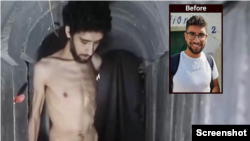 ایویاتار داوید، گروگان اسرائیلی در دست حماس (توجه: این تصویر به دلیل آن که خانواده داوید اجازه انتشار آن را داده‌اند، منتشر می‌شود) 