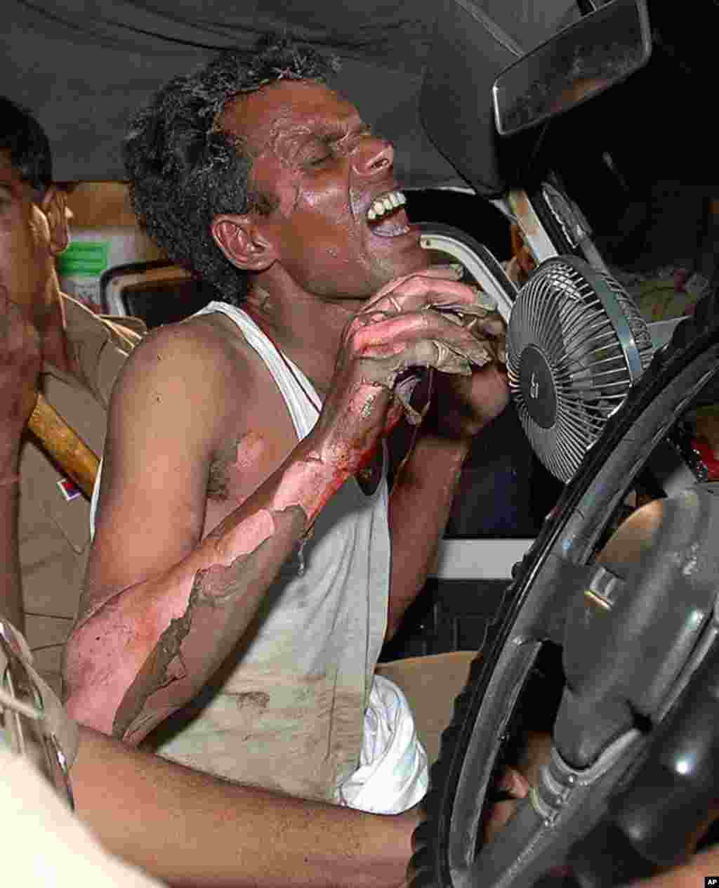 Delhi Policemen carry a man, who tried to self-immolate himself, for treatment during a protest rally in New Delhi, India. Thousands of Indian doctors and medical students protesting against a government affirmative action program for low-caste students c