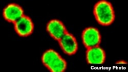 Multi-drug-resistant, gram-negative rod bacteria Acinetobacter baumannii being killed by azithromycin (green) in the presence of a human antimicrobial peptide naturally present at infection sites. (Credit: UC-San Diego School of Medicine)