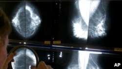 Seorang ahli radiologi menggunakan kaca pembesar untuk memeriksa mammogram guna mengetahui adanya kanker payudara di Los Angeles pada 6 Mei 2010. (Foto: AP)