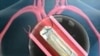 Perkembangan Terbaru Terapi Jantung dan Stroke