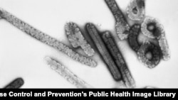 This negative stained transmission electron micrograph (TEM) depicts a number of filamentous Marburg virions. Authorities in Equatorial Guinea said, Feb. 28,2023, that 11 people have died of Marburg hemorrhagic fever.