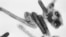 This negative stained transmission electron micrograph (TEM) depicts a number of filamentous Marburg virions. Authorities in West Africa have confirmed the region's first known case of Marburg virus after at least one person in Guinea died of the disease.
