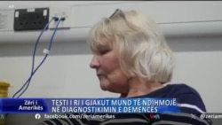 Analiza e re e gjakut mund të ndihmojë në diagnostikimin e pacientëve me demencë