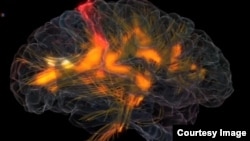 FILE - An image shows activity in a human brain. Scientists have developed a drug capable of sweeping away abnormal protein clumps in the brain which are a hallmark of Alzheimer’s disease.