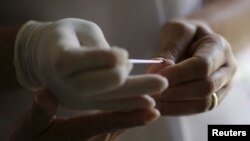FILE - A nurse prepares an emergency test to diagnose dengue at a medical care unit in the Sao Sebastiao neighborhood of Brasilia, Brazil, Feb. 19, 2016. 