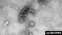 A Transmission Electron Microscopy image of the first isolated case of the coronavirus, as obtained by Reuters Jan. 27, 2020. 