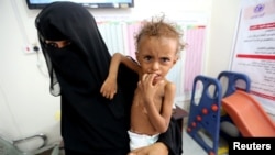 Mother of malnourished Ferial Elias, 2, holds her at a malnutrition treatment ward at al-Thawra hospital in Hodeida, Yemen, Nov. 3, 2018. 